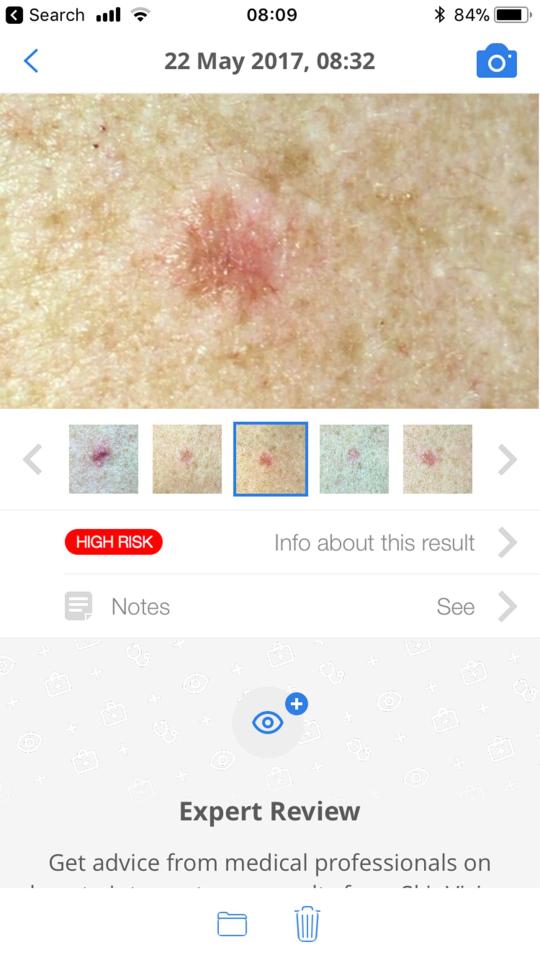  The incredible app advises users when to seek medical help for skin issues