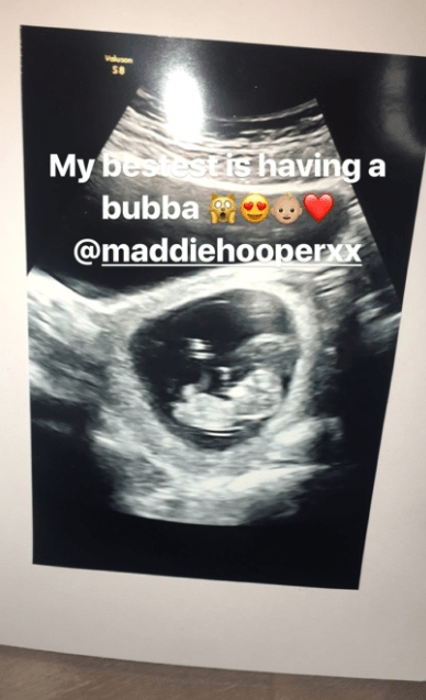  Maddie's best friend Ruby Lacey shared this picture of her scan