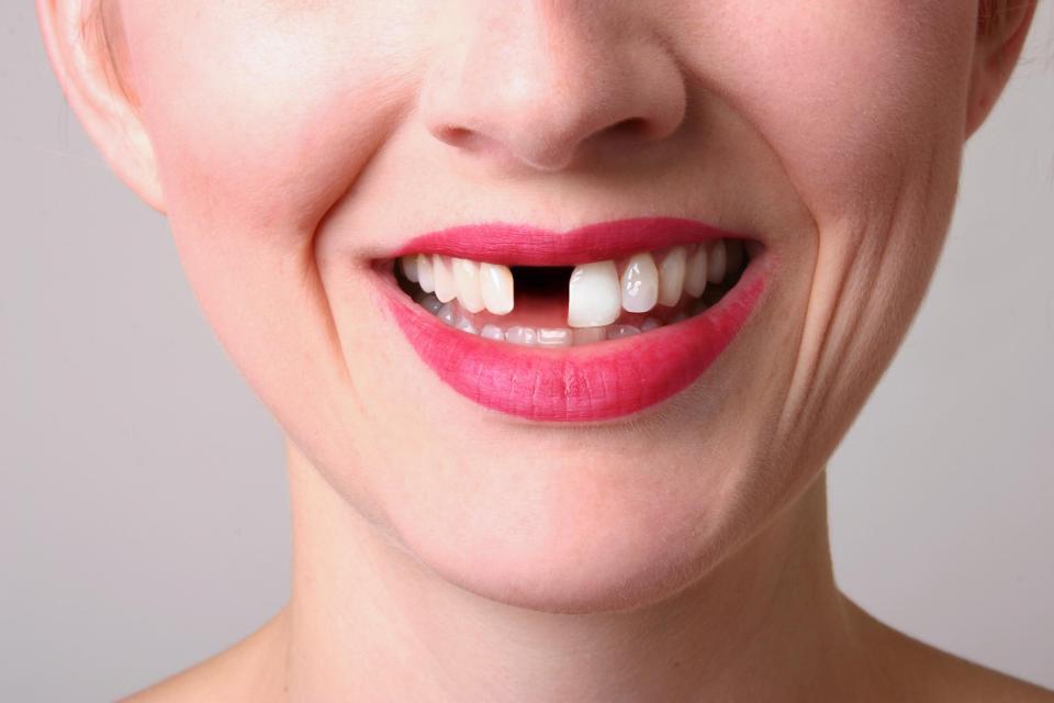  Gum disease can cause tooth loss and make your breath smell like poo