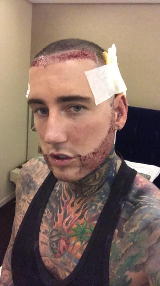  Jeremy McConnell has had a secret hair and beard transplant