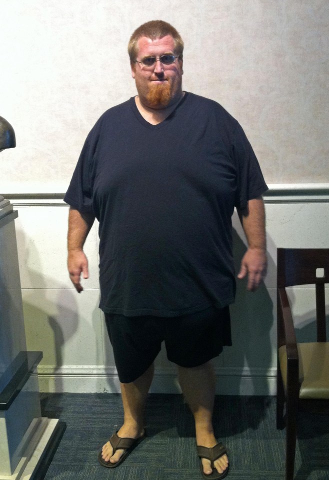 At his heaviest, Zach weighed a whopping 33 stone, and had a BMI pushing 60