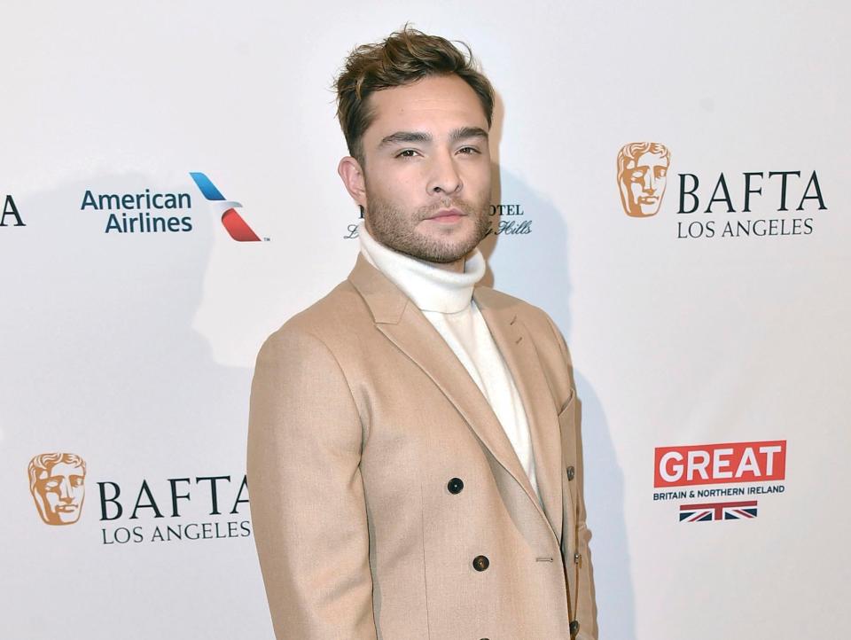  Ed Westwick is a British actor made famous by the hit TV series Gossip Girl