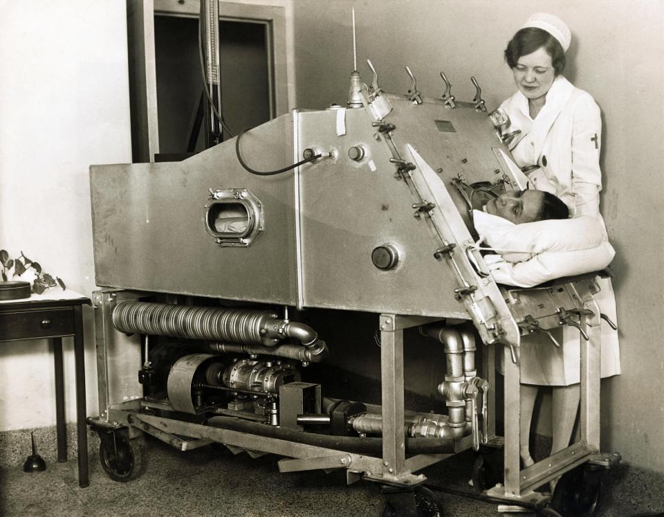  A nurse tends to a patient in an iron lung in this file image. The devices were once much more common