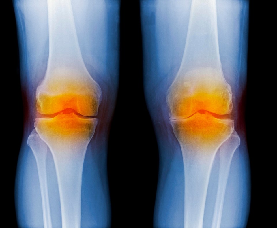 GAMA drugs are not licensed to treat pain associated with conditions like arthritis