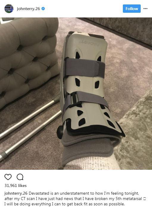  John Terry posted a picture on Instagram of his leg in a boot