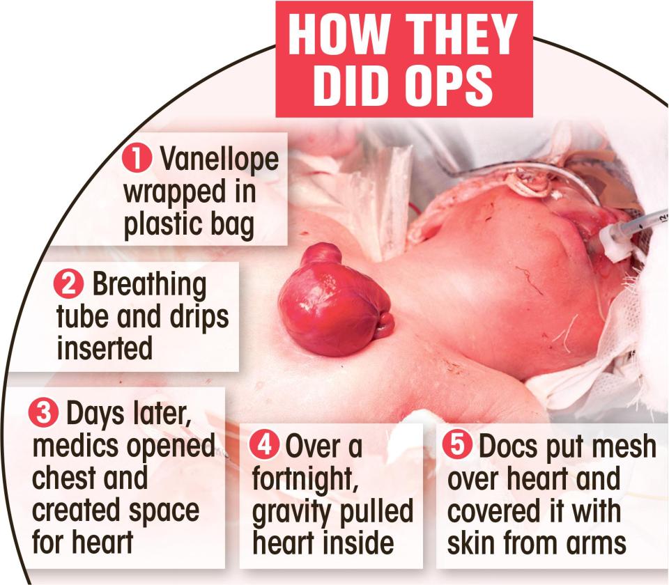  A graphic showing how skilled surgeons saved the little girl's life