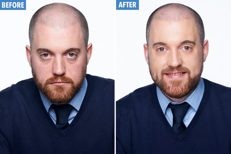 John went from hung-over to bright and perky with the help of a bit of slap