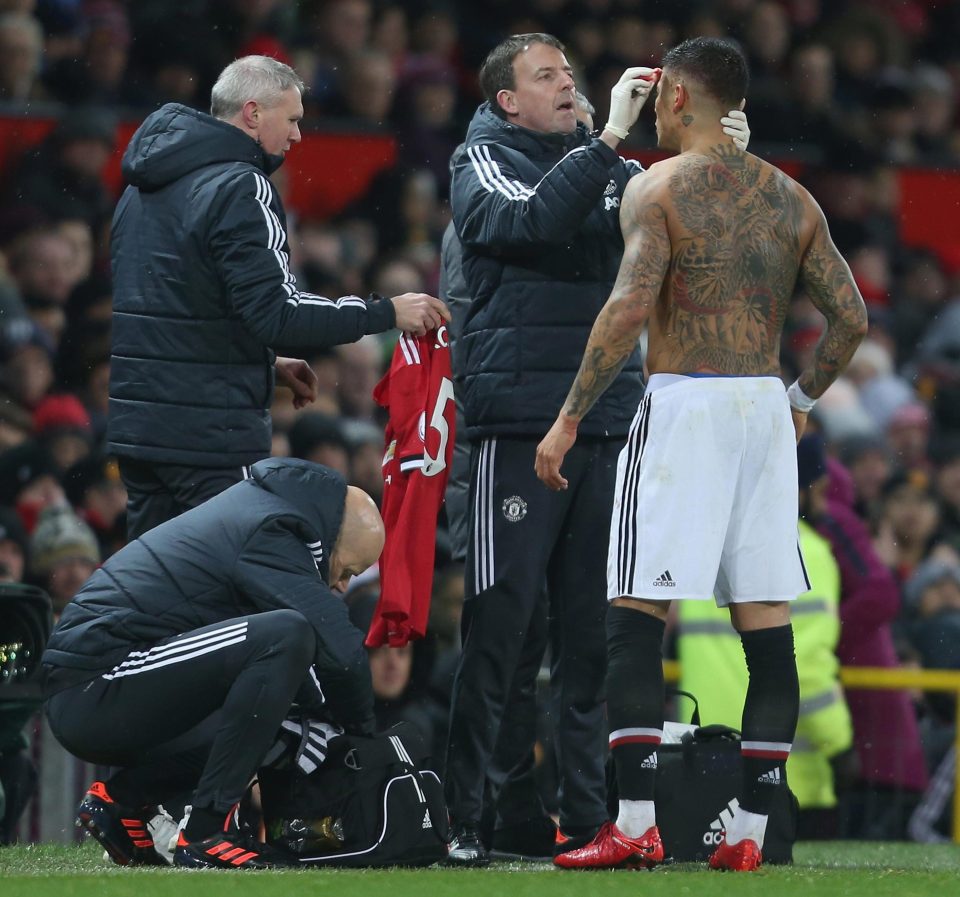  Marcos Rojo managed to stay on but had to swap his bloodied shirt