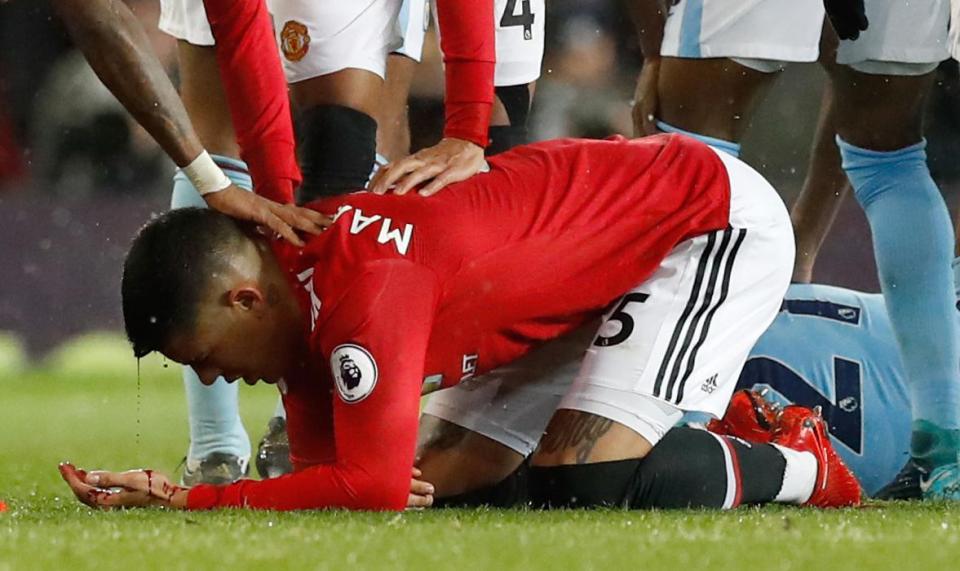  David Silva came off ofine but Marcos Rojo was hurt