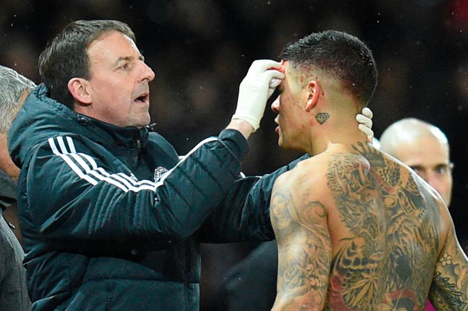  Marcos Rojo had to strip off and get his cut seen to