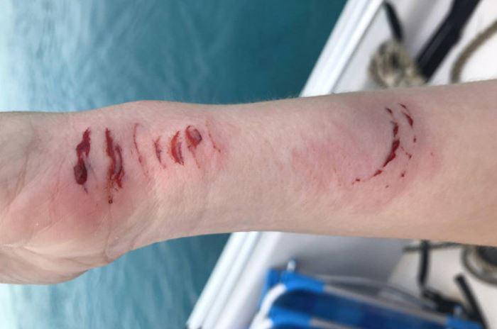  Sarah's husband Evan posted a photo of his wife's bloody injuries