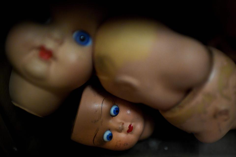  Donors give the hospital unwanted dolls to be recycled as spare parts