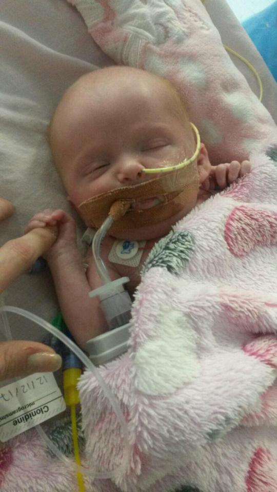  This three-week-old baby is only to survive being born with her heart outside her chest