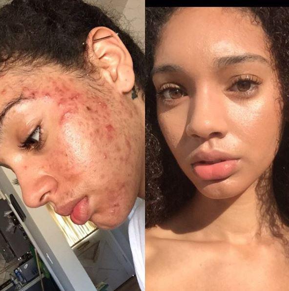  Brianna Lopez uses a special six step skin routine that she's found works magic