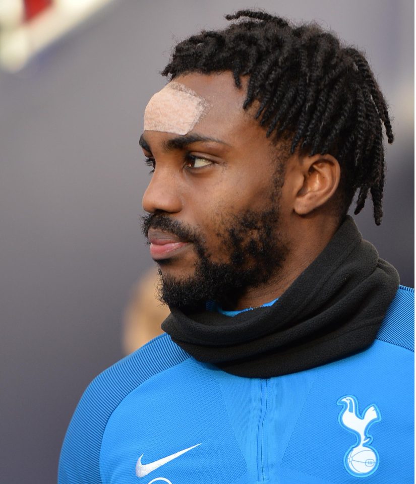  Danny Rose suffered a head injury in training