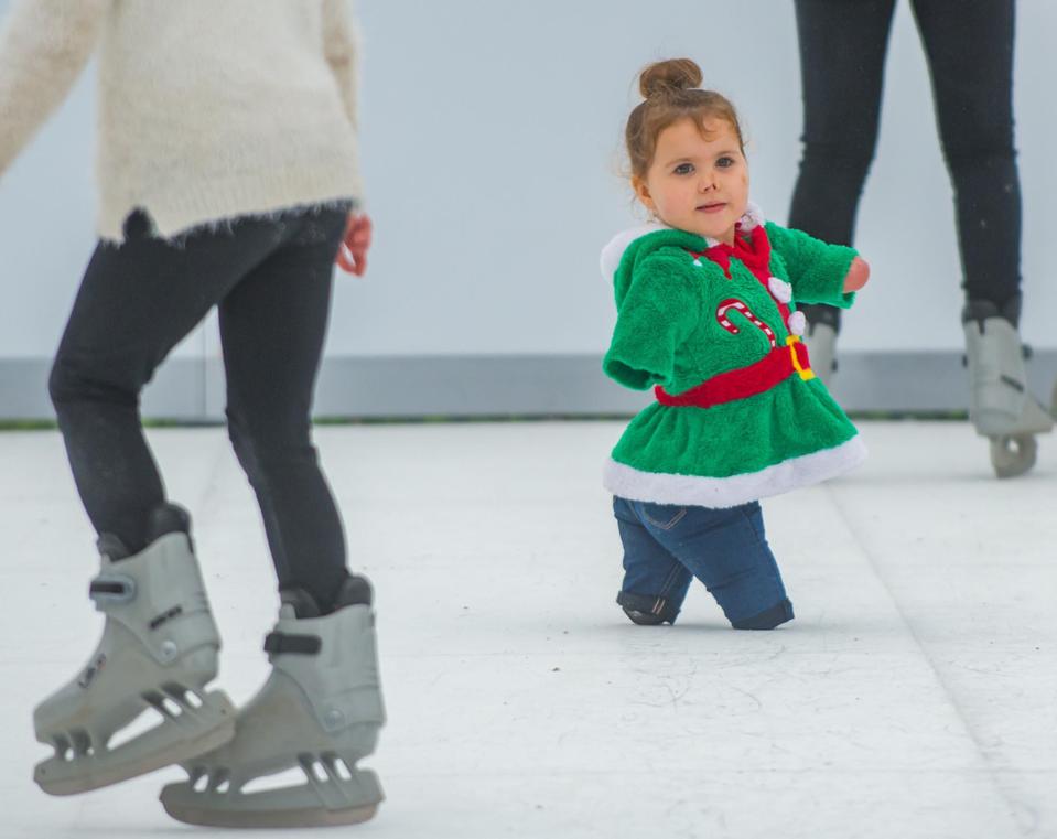  She now finds it easier to move around after being given private prosthetic legs