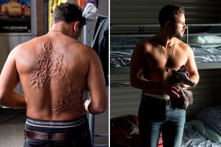 Ryan is seen with his back covered in scars in the first look at his role on Neighbours