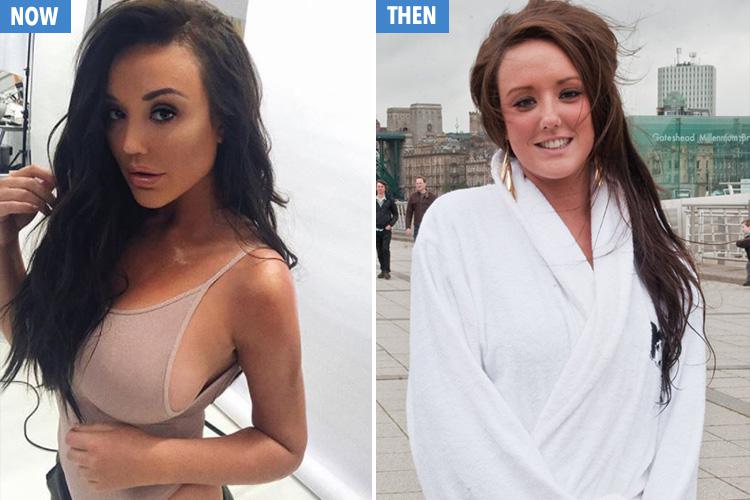  The former Geordie Shore star, 27, has famously undergone several plastic surgeries - completely changing her appearance since she shot to fame in 2011, right