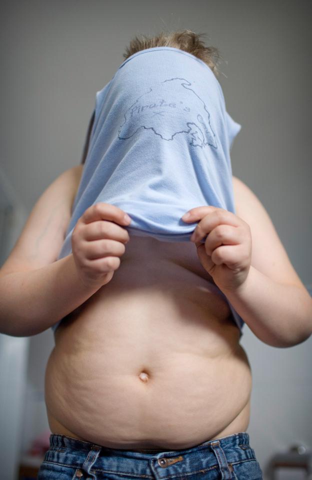  Four in five obese children are at risk of having their lives cut short by a decade