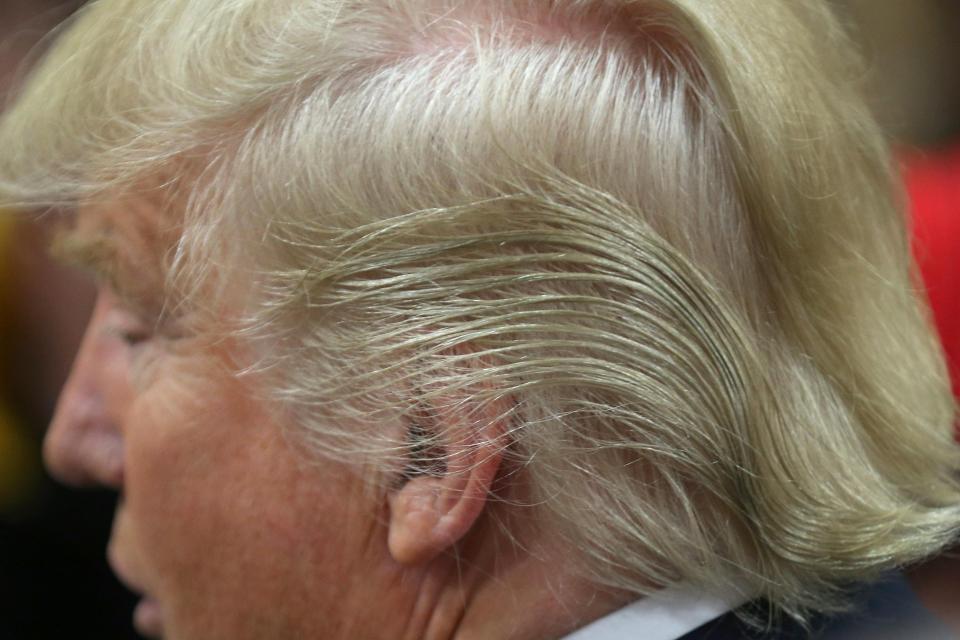  The book claims Trump's swept-back hair is the result of scalp surgery