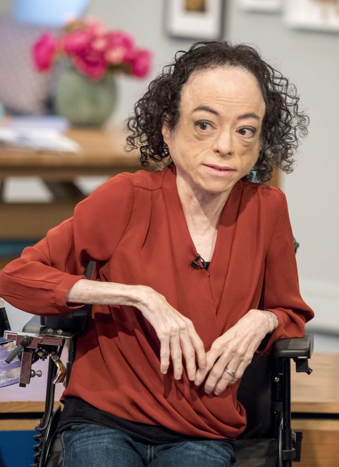  Actress Liz Carr has AMC