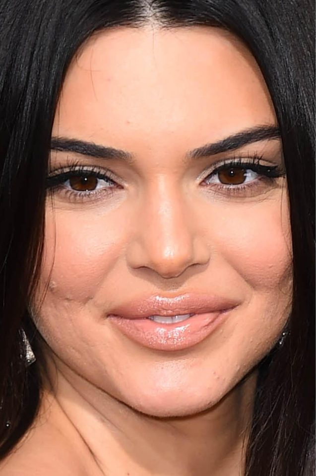  Trolls blasted Kendall over her skin at the Golden Globes