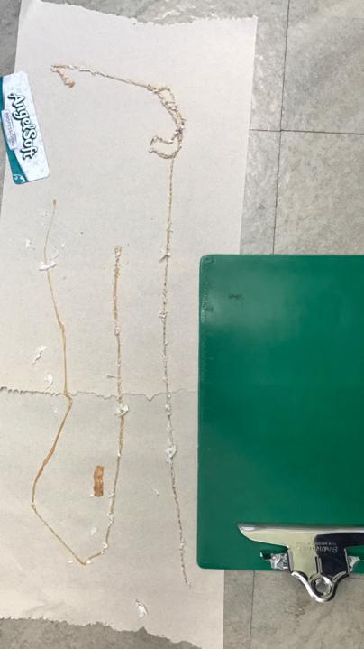 A Californian man pulled this five foot tapeworm out of his backside, after doctors think he picked up the parasite from raw salmon