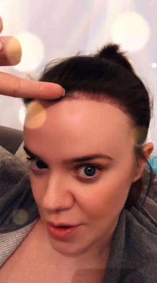  Maria Fowler has shown fans how her hair transplant is progressing