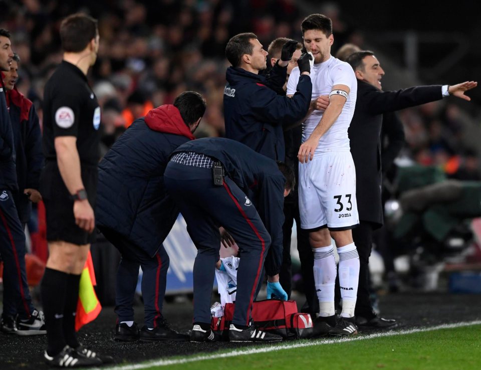  Fernandez required a new shirt to replace the bloodied jersey before he could go back onto the pitch