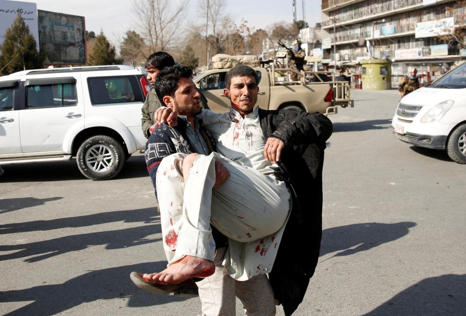  At least 158 people were injured in the blast carried out by the Taliban