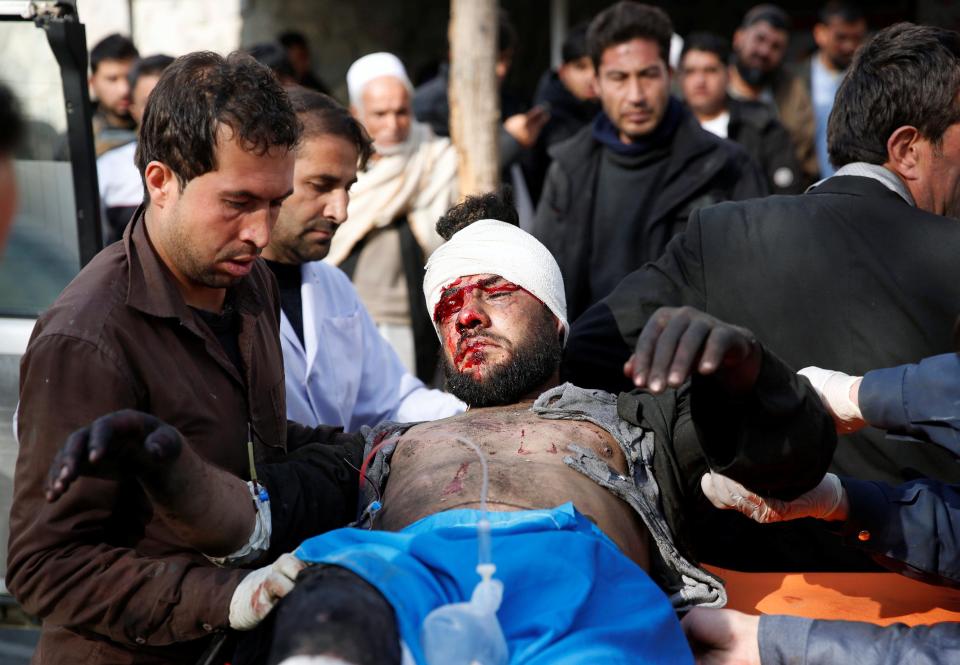  A man being treated for his wounds following the blast