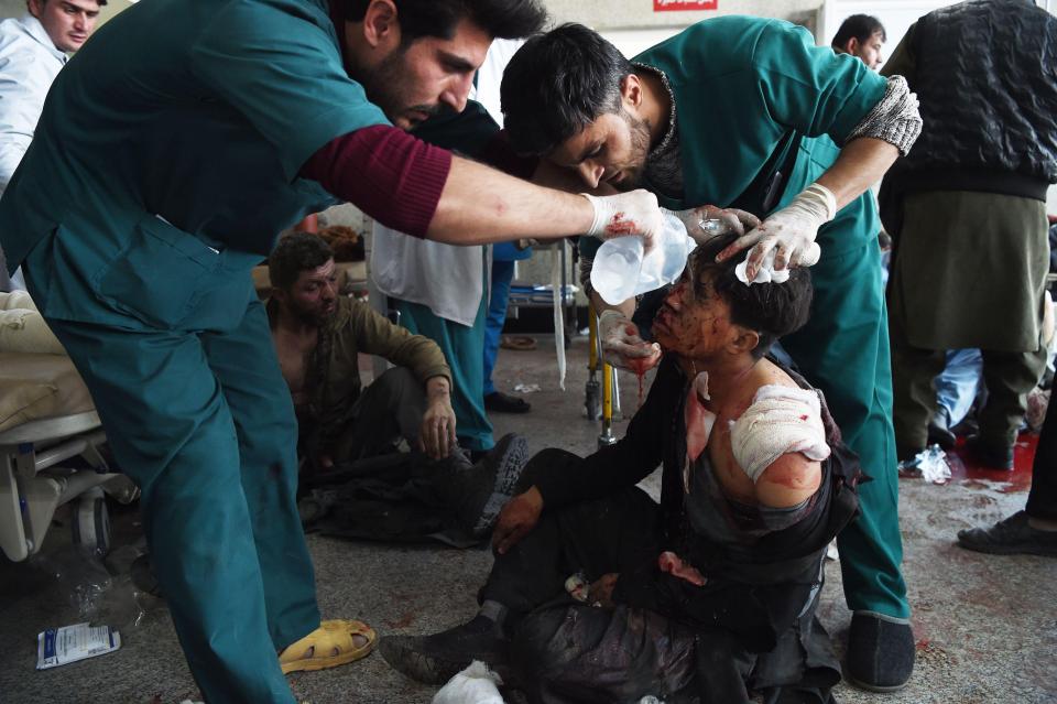  The Afghan government said 150 victims were being treated in the city's hospitals