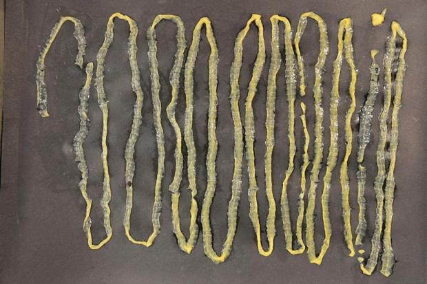 A man was found to have a huge 9-foot tapeworm in his stomach