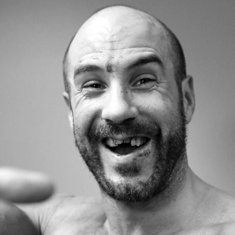  Cesaro smashed his teeth in after a bloody accident