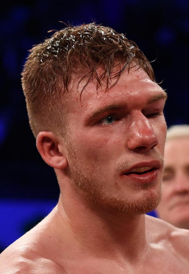  Nick Blackwell was put in an induced coma after suffering a bleed on the brain after a fight with Eubank Jr in 2016