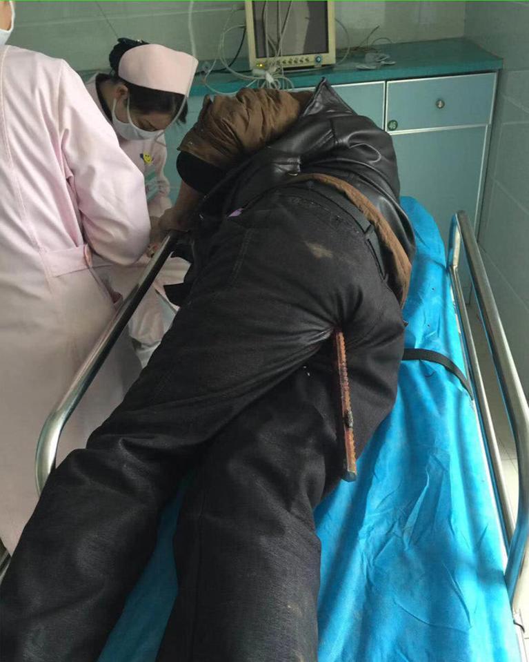 A Chinese construction worker was impaled by a two-foot-long steel bar