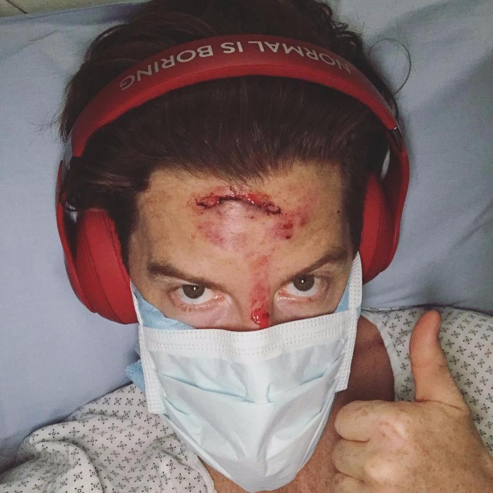  Brave Shaun White needed 62 stitches to repair his face after a training accident