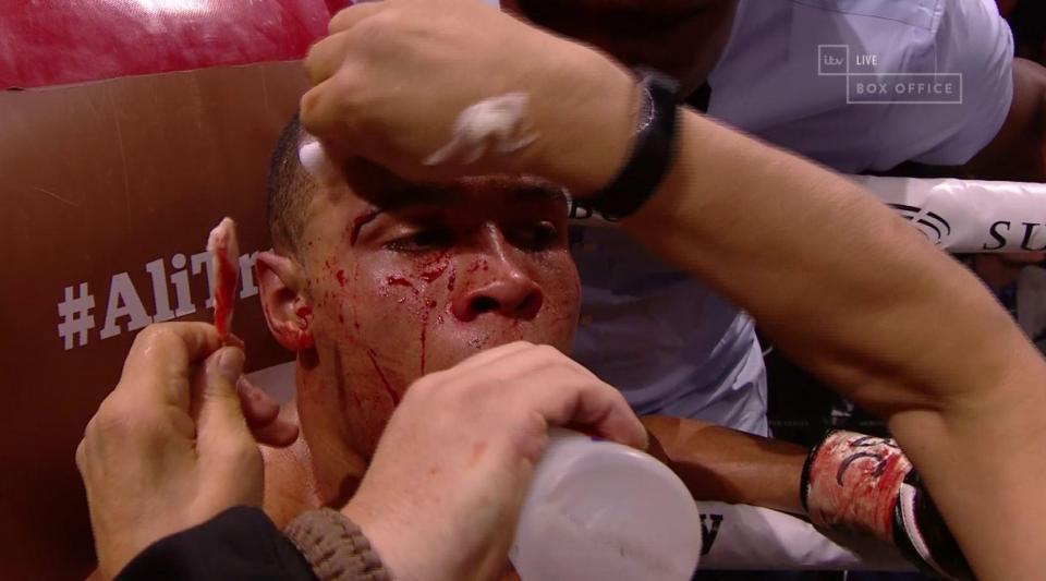  Chris Eubank Jr's corner had to work overtime to sort a horror cut