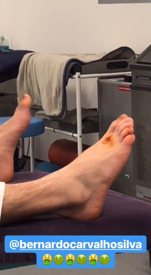  The French defender then shared a clip of Bernardo Silva's feet