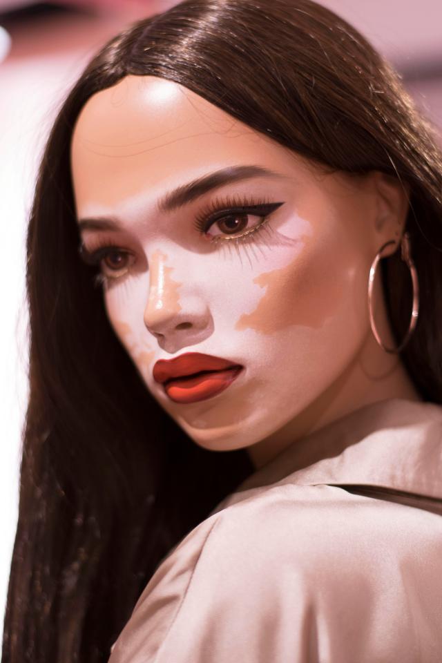  Missguided's new mannequins have vitiligo and freckles