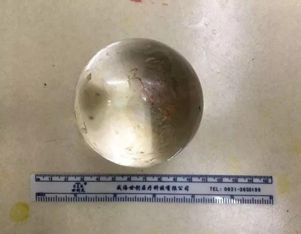 The 3.5in ball found inside Ming’s rectum