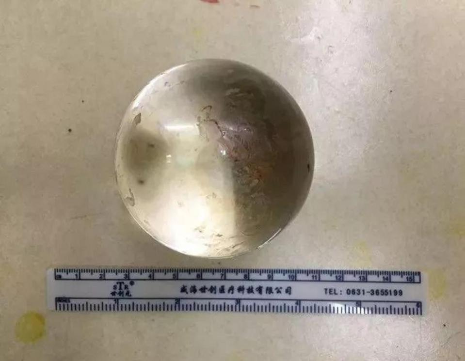  The 3.5in ball found inside Ming's rectum