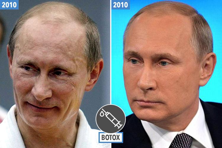  A very wrinkly looking Putin pictured after a judo session back in 2010 (left). But months later, Putin looked bronzed and wrinkle-free (right). Dr Lambe says this is down to "some quite successful Botox work"