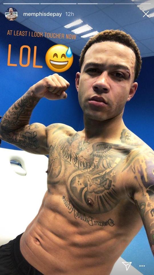  Memphis Depay joked the cut made him look tougher after being stitched up