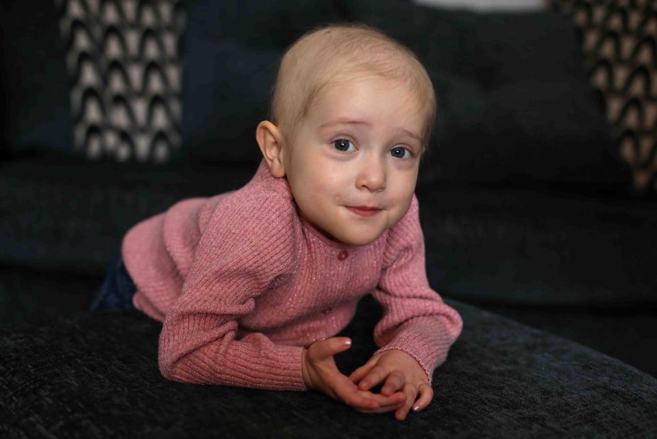  Daisy Sayers, 2, has been diagnosed with acute lymphoblastic leukaemia and faces two years of treatment