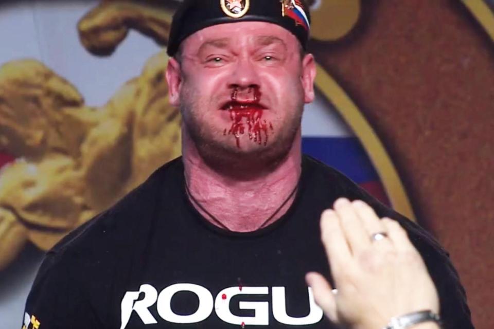  Mikhail Shivlyakov bled profusely from his nose as he attempted a near-half ton dead lift