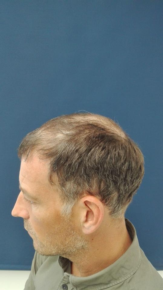  Ex-Prem ref Mark Clattenburg's hair was started to thin out