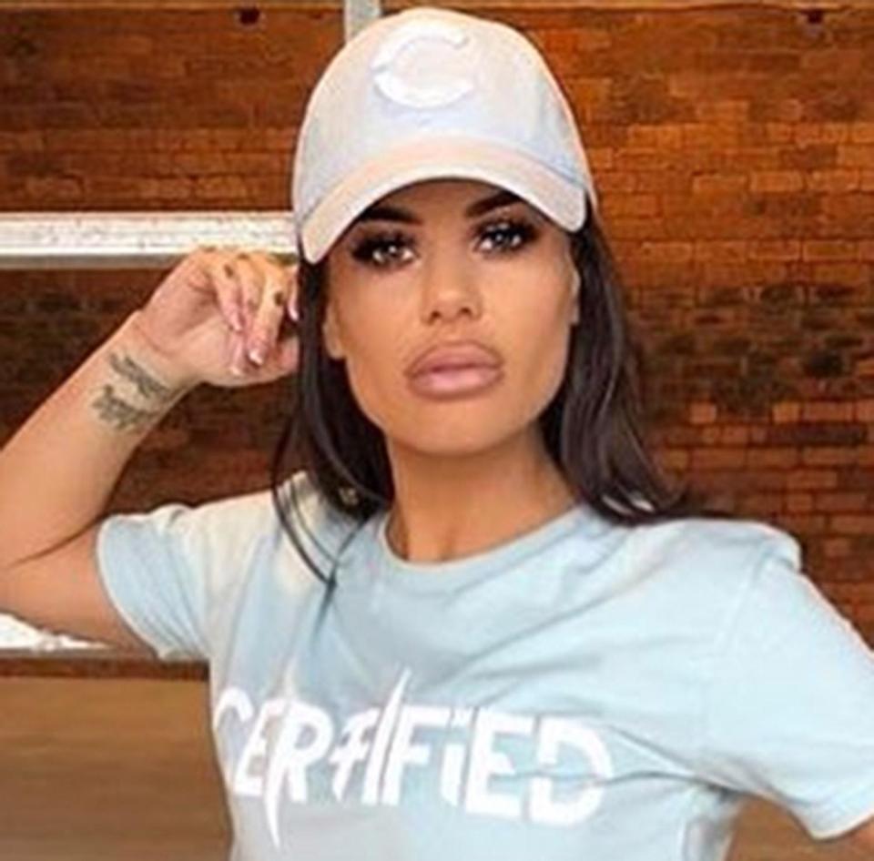  Fans of former Geordie Shore star Chantelle Connelly are worried she's taken her love of lip fillers too far after her latest Instagram uploads