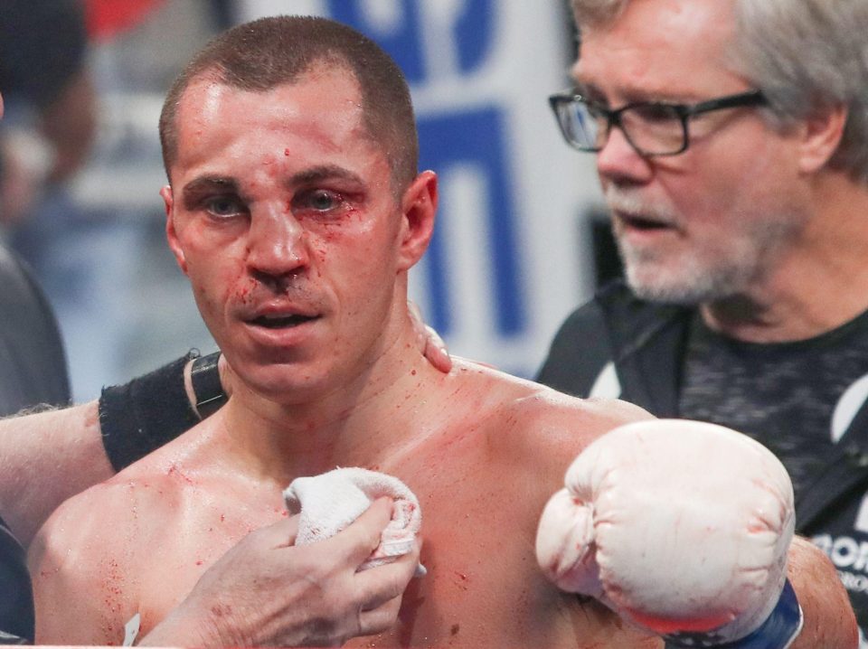  Scott Quigg broke his nose in the fifth round of his defeat to Oscar Valdez in California