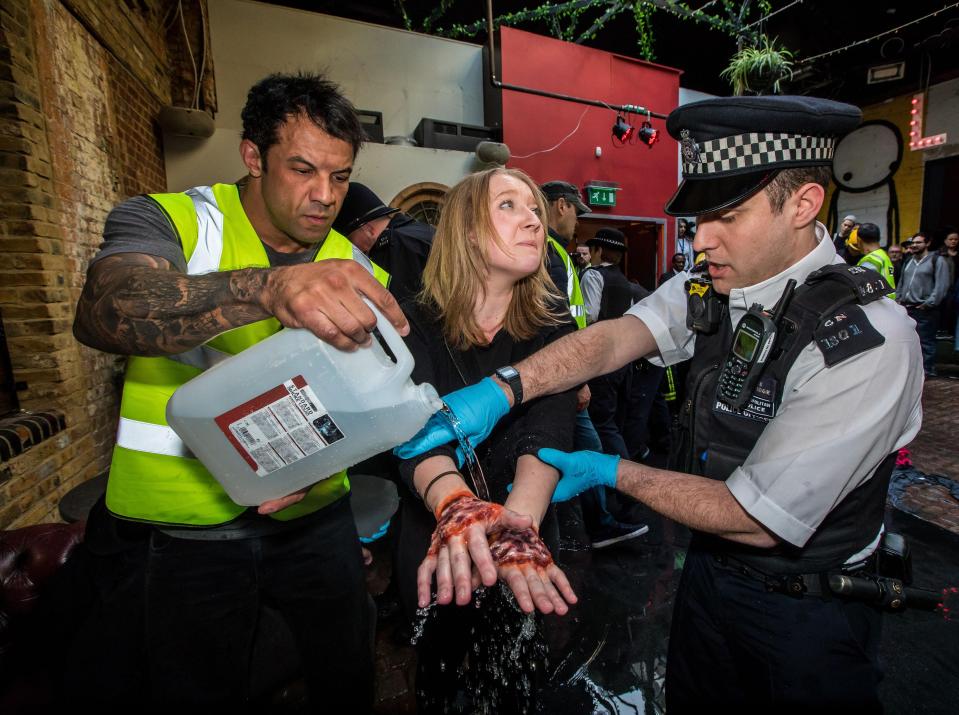  Horror hand burns are treated by pouring water over them